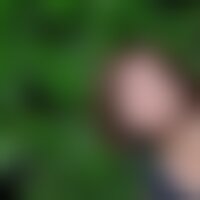 Citronvert